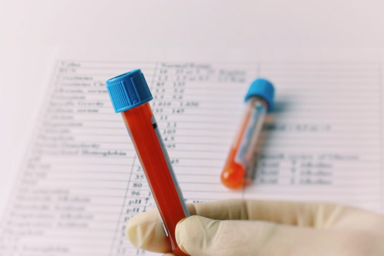 30 Anti-Aging Secrets That Could Add Years To Your Life 24 11 Things Doctors Need You To Know About Childhood Alzheimers 2