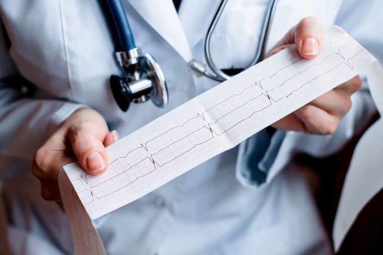 15 Things Neurologists Do To Prevent Alzheimer’s Disease 10 15 Things Neurologists Do To Prevent Alzheimers Disease 9