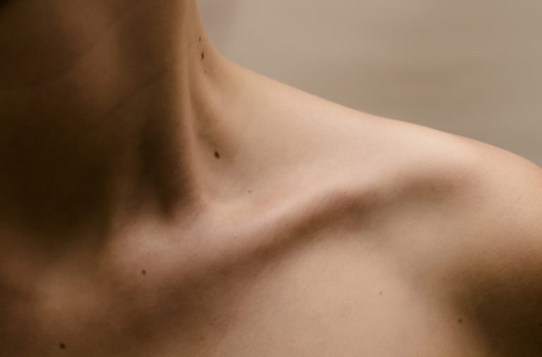 13 Medical Reasons For Your Shoulder Pain 7 The 14 Worst Places On Your Body To Get A Sunburn 2