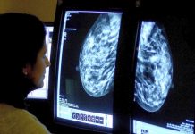 Less Fat, More Fruit May Cut Risk of Dying of Breast Cancer