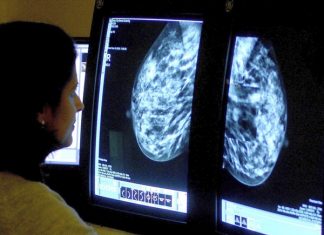 Less Fat, More Fruit May Cut Risk of Dying of Breast Cancer