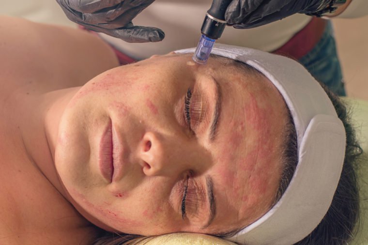 12 Bizarre-Sounding Anti-Aging Treatments That Really Work 1 Shutterstock 1022553481