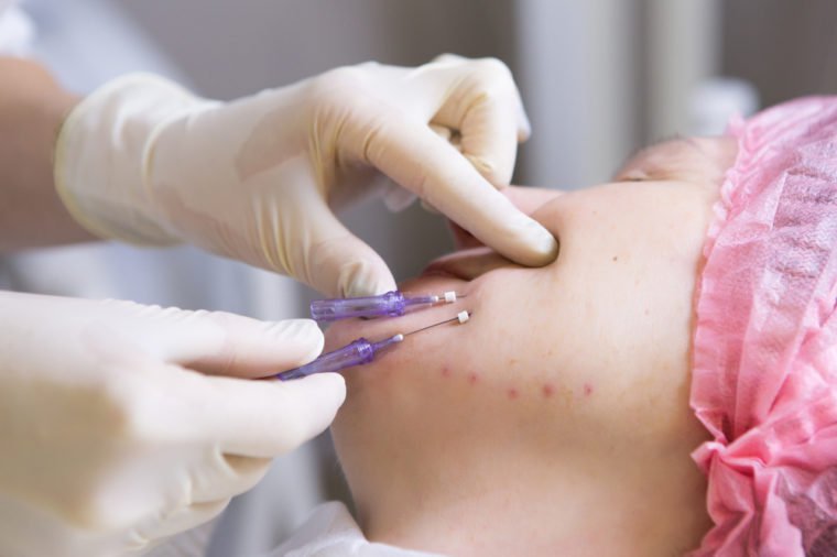 12 Bizarre-Sounding Anti-Aging Treatments That Really Work 7 Shutterstock 1234042897