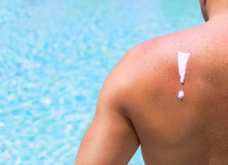 How A Sunburn Increases Your Risk For Skin Cancer, Even If You Wear Sunscreen