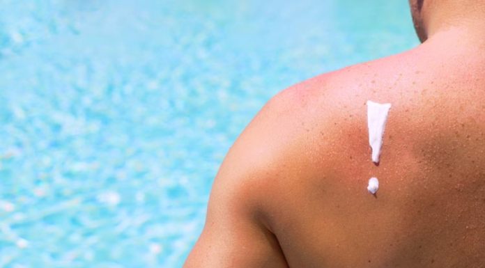 How A Sunburn Increases Your Risk For Skin Cancer, Even If You Wear Sunscreen